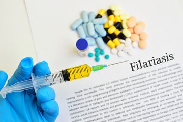 Filariasis treatment in Nigeria