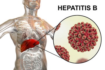 Hepatitis B in Nigeria