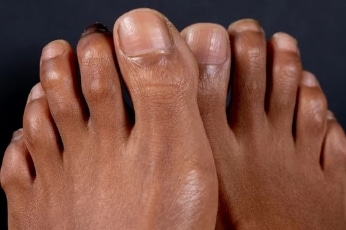 How to Keep Your Toenails Healthy