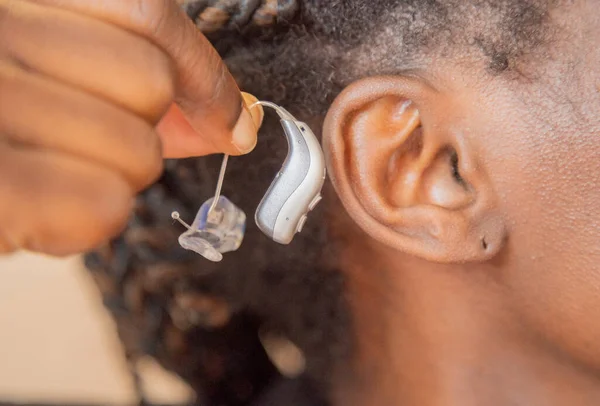 How To Know If You Need Hearing Aids